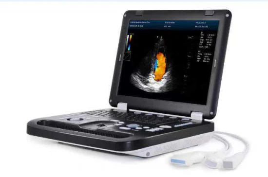 B-Ultrasonic Scanner for Ruminant Livestock